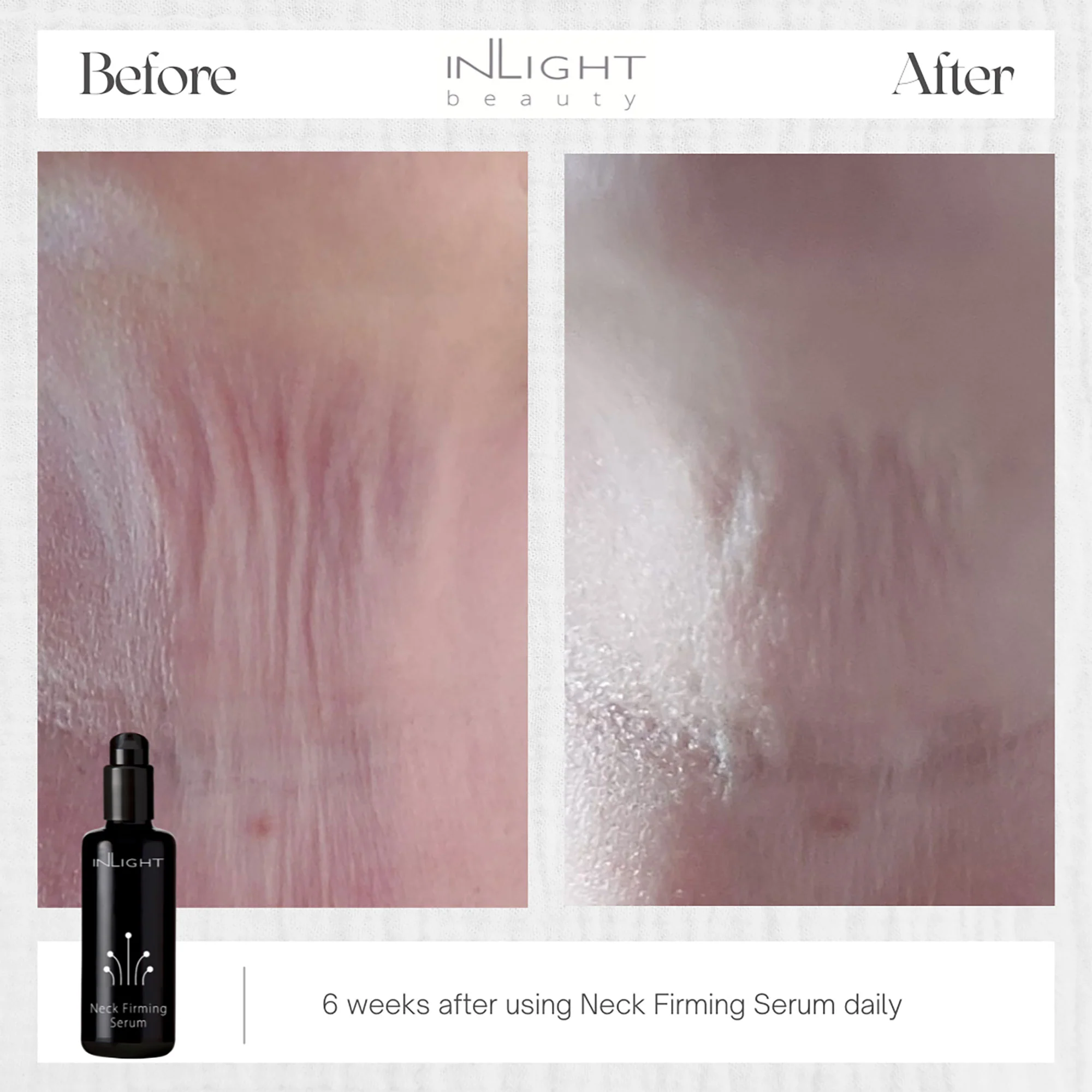 Inlight Neck Firming Serum - Image 5